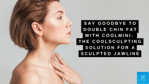 coolsculpting double chin fat bucks county pa