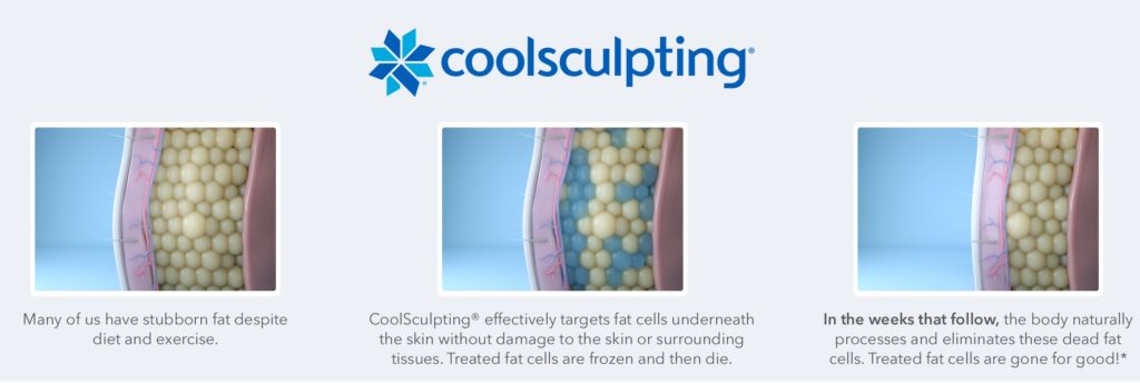 How does coolsculpting work?
