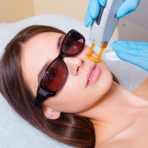 Laser Hair Removal Treatment
