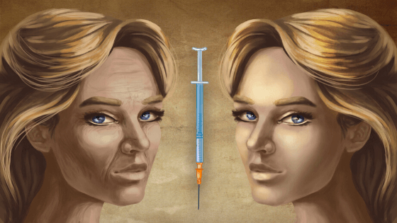 Ultimate Botox Guide 2020