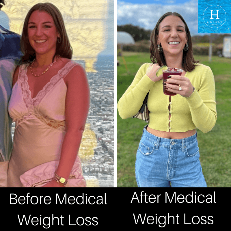 medical weight loss before and after healthy Solutions medspa