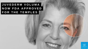 juvederm voluma fda approved for temples bucks county pa