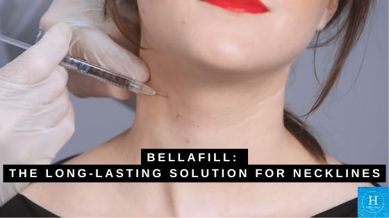 Bellafill: The Long-Lasting Solution for Necklines