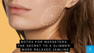 Botox for Masseters: The Secret to a Slimmer, More Relaxed Jawline