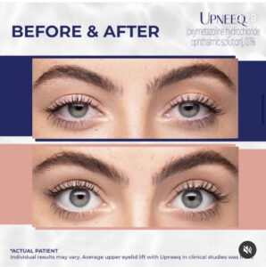 Upneeq at Healthy Solutions Medspa