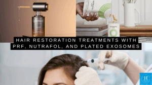 Hair Restoration Treatments with PRF, Nutrafol, and Plated Exosomes
